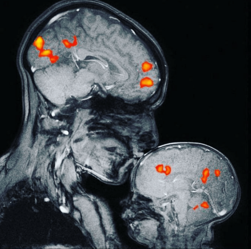 La química del AMOR